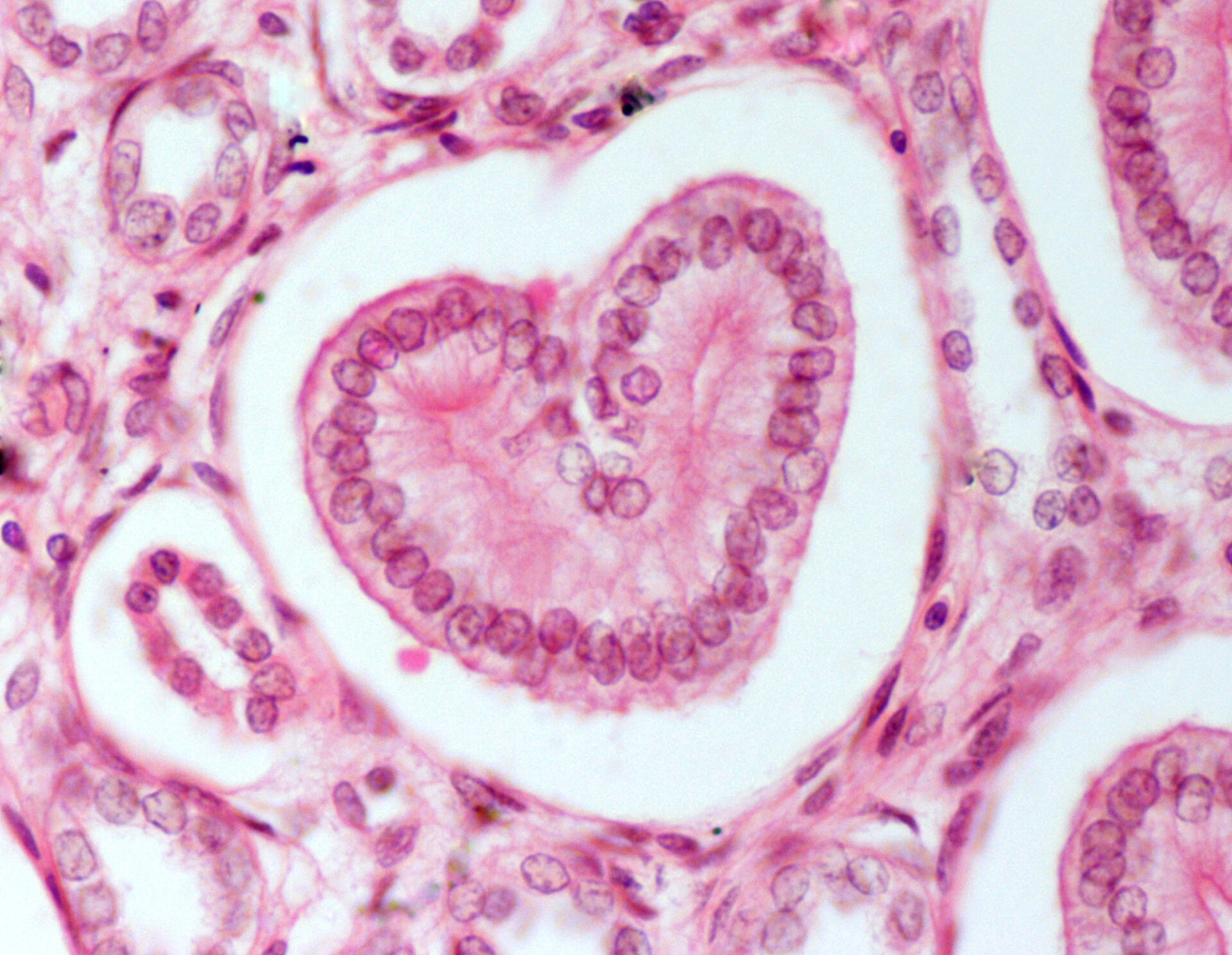 Kidney histological section in which the “heart” represents collecting tubule