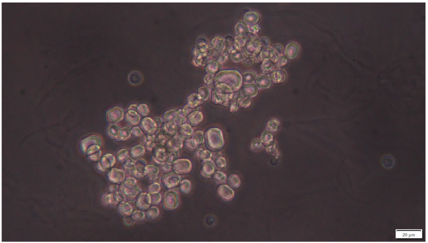 Monohydrate calcium oxalate crystals (phase contrast, 400x)